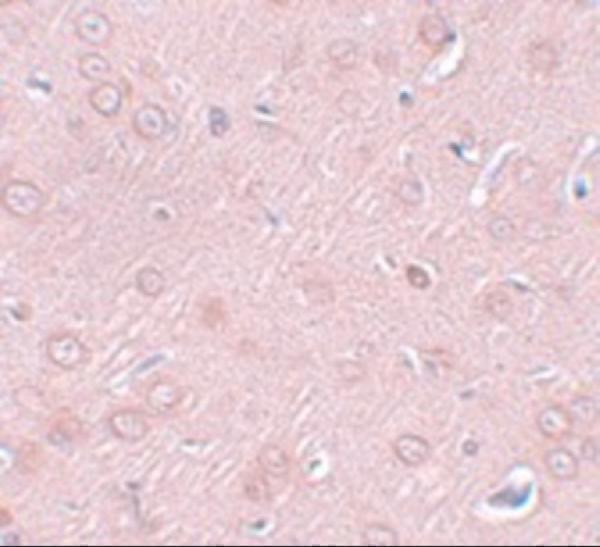 a13004 syngr2 primary antibodies ihc testing 2