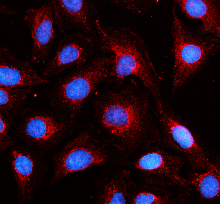 a13011 2 mrpl14 primary antibodies if testing 1