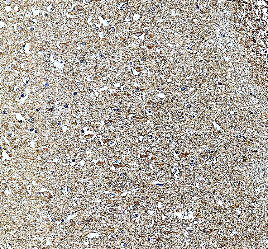 IHC analysis of MRPL14 using anti-MRPL14 antibody (A13011-2)
