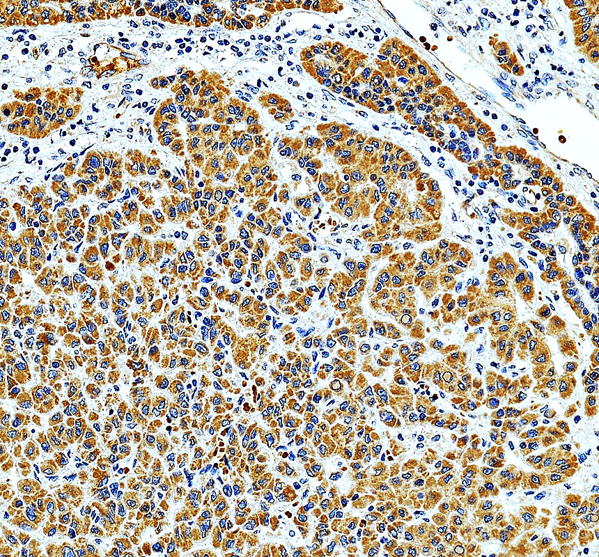 IHC analysis of MRPL14 using anti-MRPL14 antibody (A13011-2)