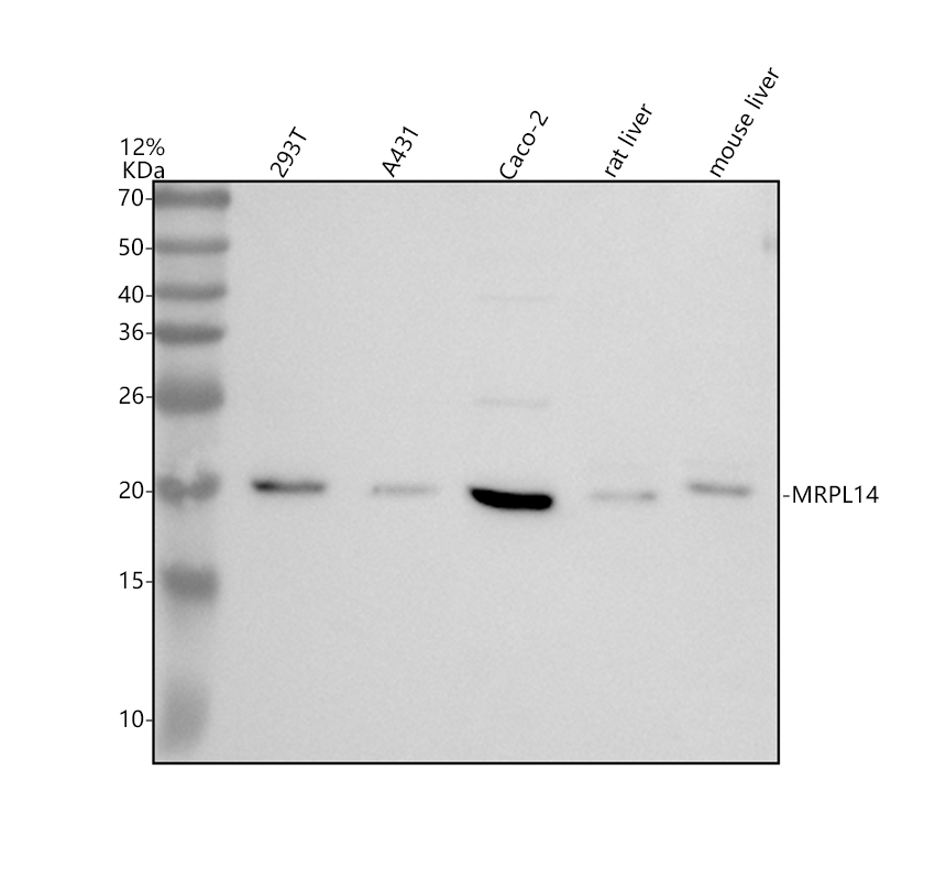 Western blot analysis of MRPL14 using anti-MRPL14 antibody (A13011-2)