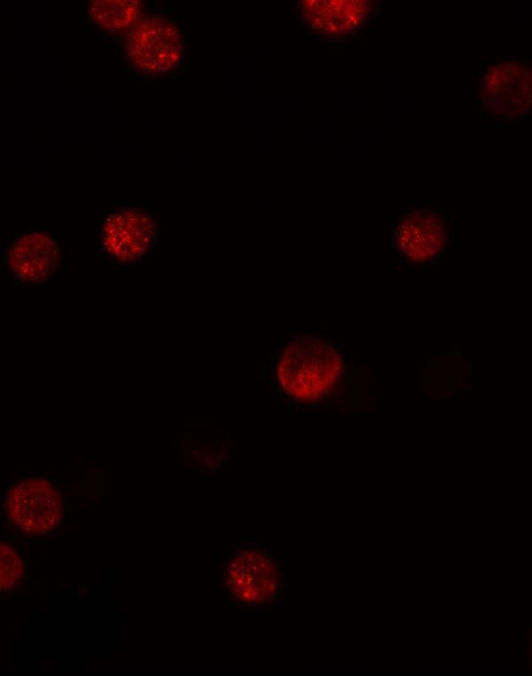 a13012 gbp6 primary antibodies if testing 3