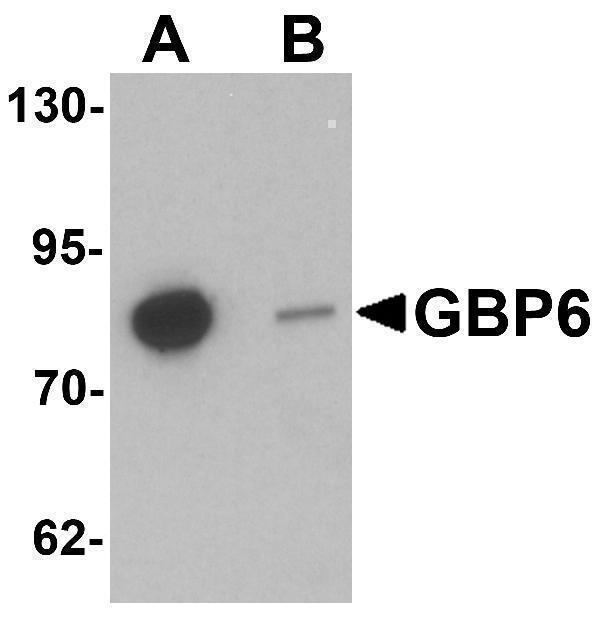 a13012 gbp6 primary antibodies wb testing 1