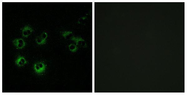 a13013 gpr42 primary antibodies if testing 1
