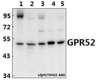 a13015 1 gpr52 primary antiboties wb testing 1