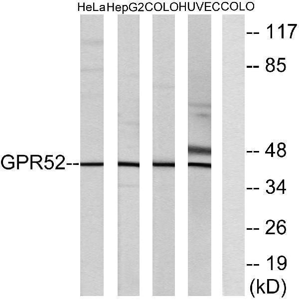 a13015 gpr52 primary antibodies wb testing 1