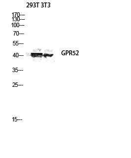 a13015 gpr52 primary antibodies wb testing 3