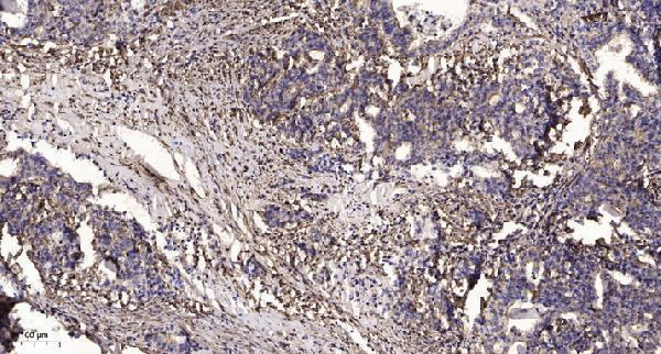 a13020 stmn4 primary antibodies ihc testing 1