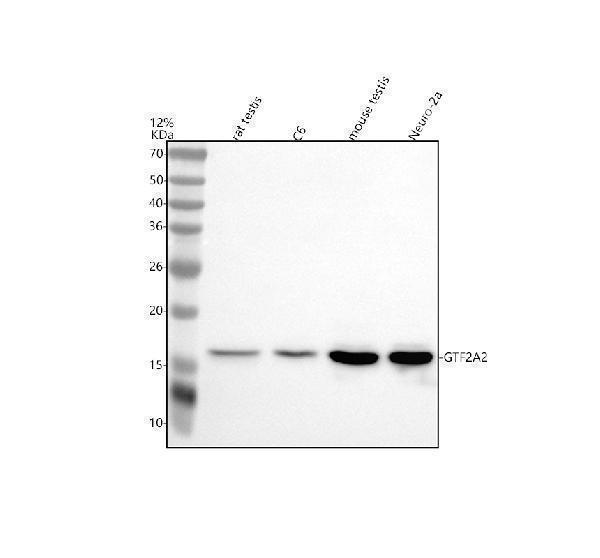 Western blot analysis of GTF2A2 using anti-GTF2A2 antibody (A13029-1)