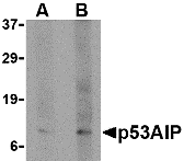 a13037 1 tp53aip1 primary antibodies wb testing 1
