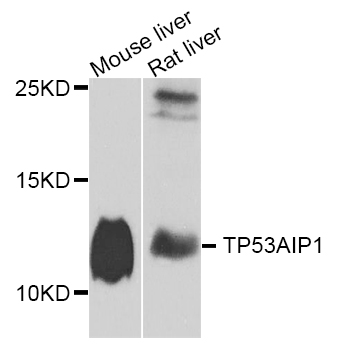 a13037 2 tp53aip1 primary antiboties wb testing 1