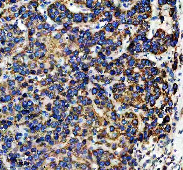 IHC analysis of ELAC1 using anti-ELAC1 antibody (A13042-2)