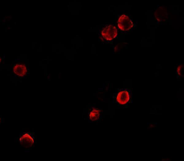 Immunofluorescence of SOGA1 in HeLa cells with SOGA1 antibody at 5 μg/mL