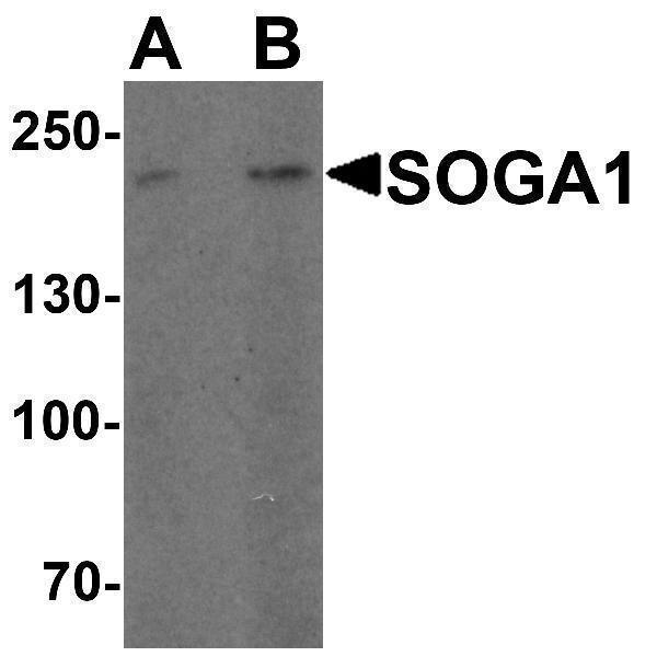 Western blot analysis of SOGA1 in Hela cell lysate with SOGA1 antibody at (A) 1 and (B) 2 μg/ml