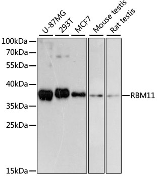 a13050 rbm11 primary antiboties wb testing 1