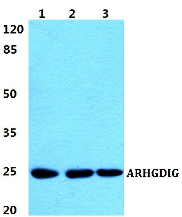 Western blot (WB) analysis of ARHGDIG polyclonal antibody at 1:500 dilution
Lane1:Jurkat cell lysate
Lane2:Hela cell lysate
Lane3:Raw264