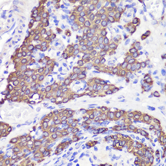 Immunohistochemistry of paraffin-embedded rat testis using UBL3 antibody  at dilution of 1:100 