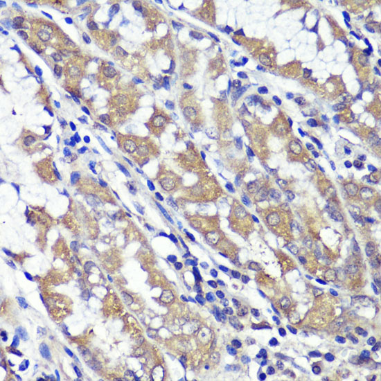 Immunohistochemistry of paraffin-embedded human stomach using UBL3 antibody  at dilution of 1:100 
