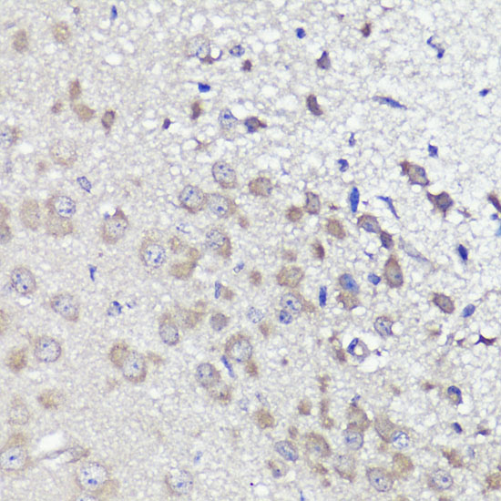 a13057 ubl3 primary antiboties ihc testing 4