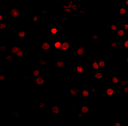 Immunofluorescence of rim3 in human brain tissue with rim3 antibody at 5 μg/mL