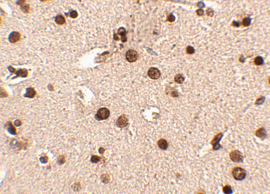 Immunohistochemistry of Rim3 in human brain tissue with Rim3 antibody at 2