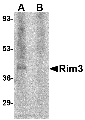 Western blot analysis of Rim3 in human brain tissue lysate with Rim3 antibody at 1 μg/mL in the (A) absence and (B) presence of blocking peptide