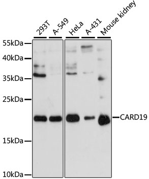 a13064 1 card19 primary antiboties wb testing 1