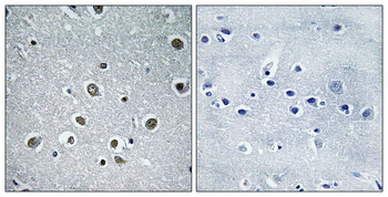 Immunohistochemistry validation of POLR3H using Anti-POLR3H Antibody (A13065-1)