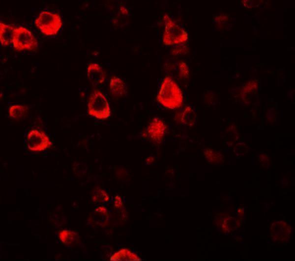 a13072 cxxc4 primary antibodies if testing 3