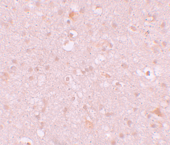 a13072 cxxc4 primary antibodies ihc testing 2