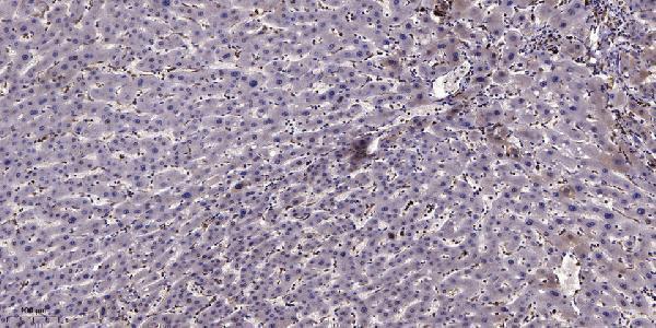a13075 1 gpc2 primary antibodies ihc testing 1