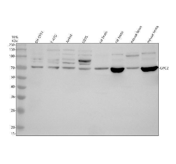 Western blot analysis of GPC2 using anti-GPC2 antibody (A13075-2)