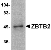 a13096 zbtb2 primary antibodies wb testing 1