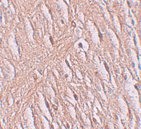 a13097 2 slc39a9 primary antibodies ihc testing 2