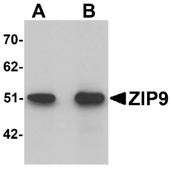 a13097 2 slc39a9 primary antibodies wb testing 1