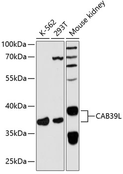 Western blot analysis of extracts of various cell lines, using CAB39L antibody  at 1:3000 dilution