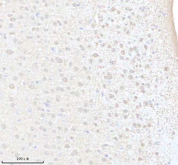 a13105 1 gsx1 primary antibodies ihc testing 1