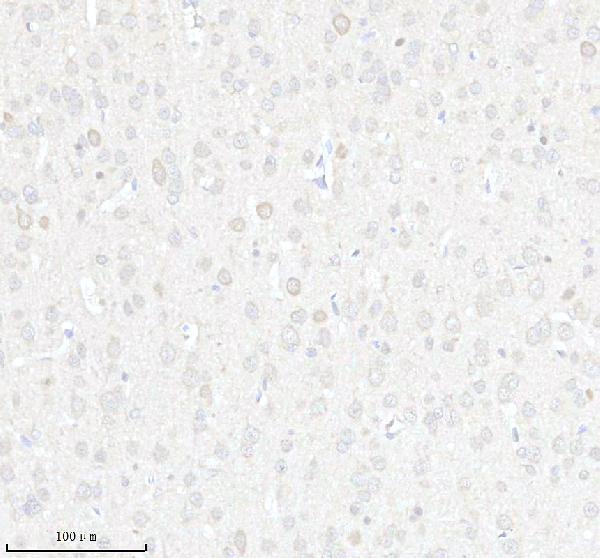 a13105 1 gsx1 primary antibodies ihc testing 2