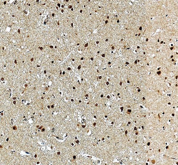a13105 1 gsx1 primary antibodies ihc testing 3