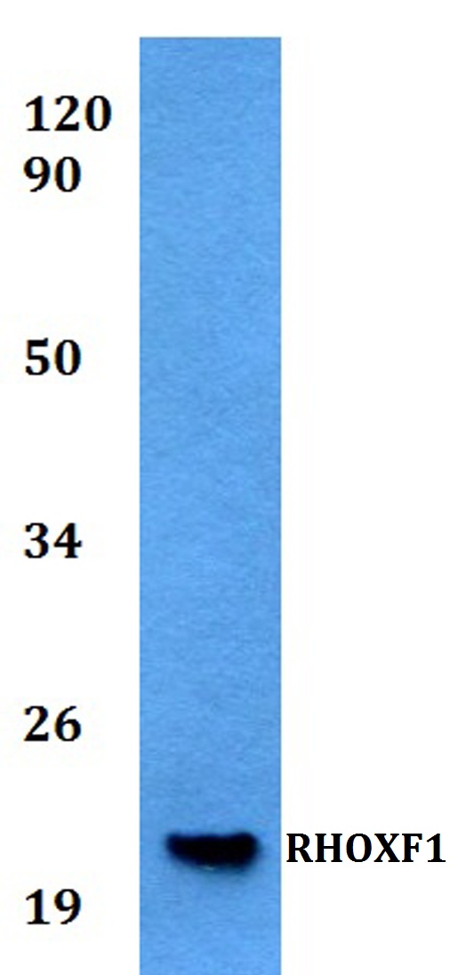 Western blot (WB) analysis of RHOXF1 polyclonal antibody at 1:500 dilution
Lane1:Jurkat whole cell lysate