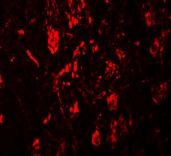 a13110 lrrtm4 primary antibodies if testing 3