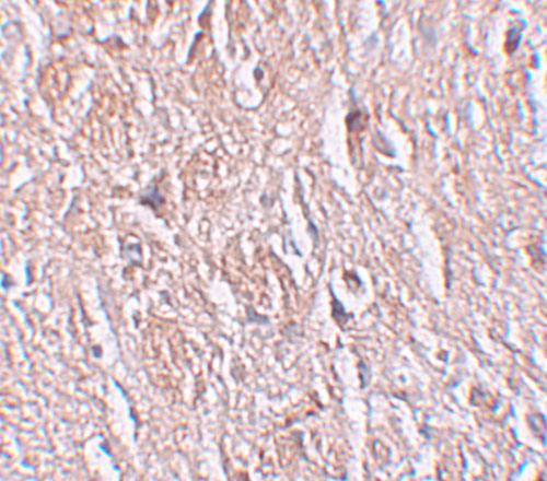a13110 lrrtm4 primary antibodies ihc testing 2