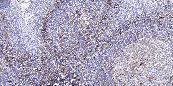 a13113 1 akr1e2 primary antibodies ihc testing 1