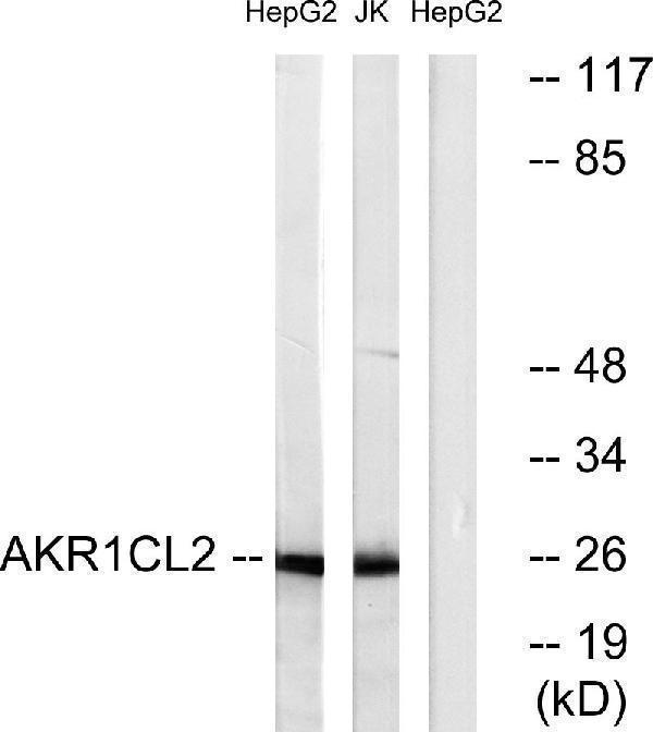 Western blot analysis of lysates from HepG2 and Jurkat cells, using AKR1CL2 Antibody