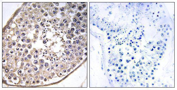a13115 dnal4 primary antibodies ihc testing 1
