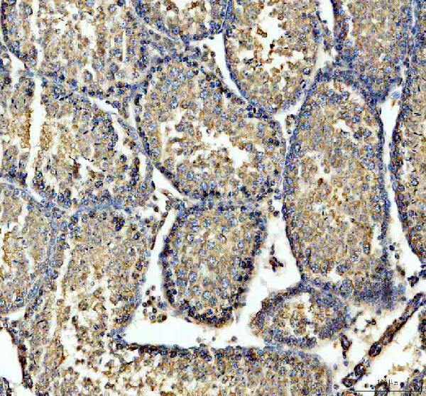 a13119 1 gsg1 primary antibodies ihc testing 2