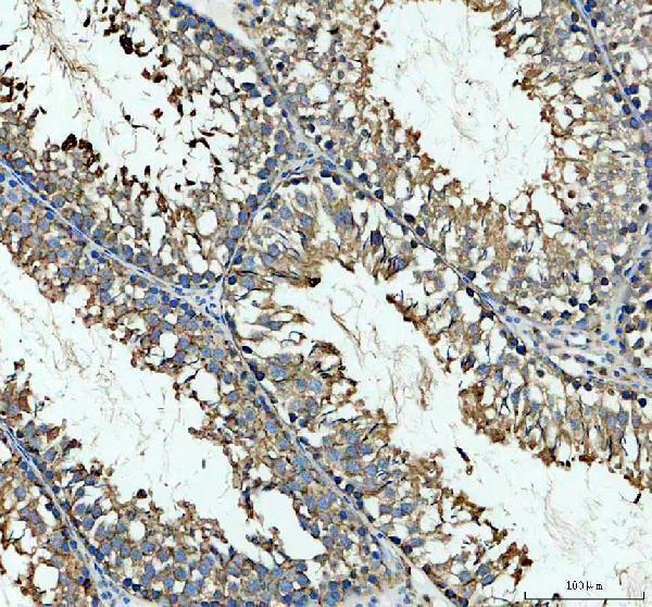 a13119 1 gsg1 primary antibodies ihc testing 3