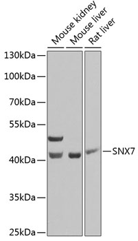 a13128 snx7 primary antiboties wb testing 1