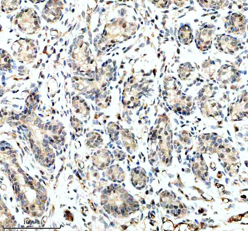IHC analysis of RBM27 using anti-RBM27 antibody (A13137)