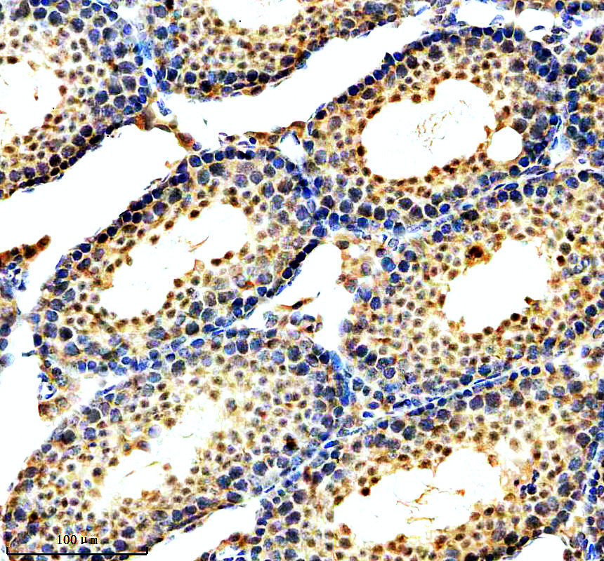 a13137 rbm27 primary antibodies ihc testing 3